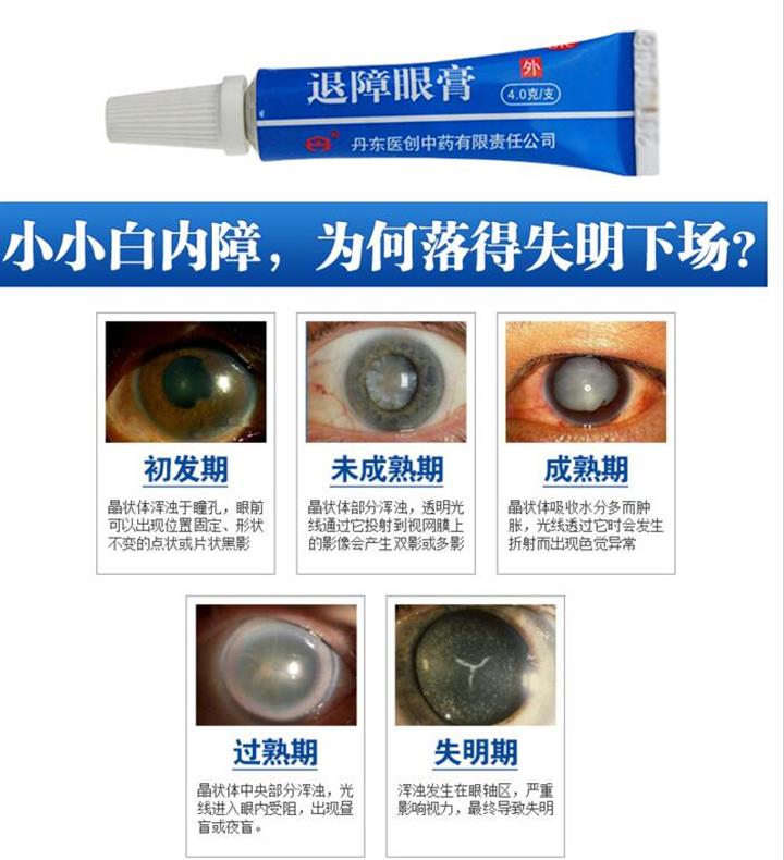 退障眼膏 多少钱一盒 240元
